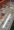 Maxillofacial